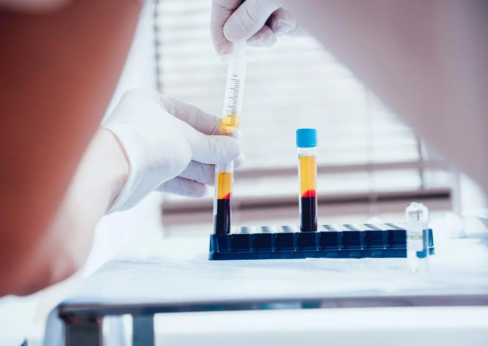 What Can PRP Injections Do for You?