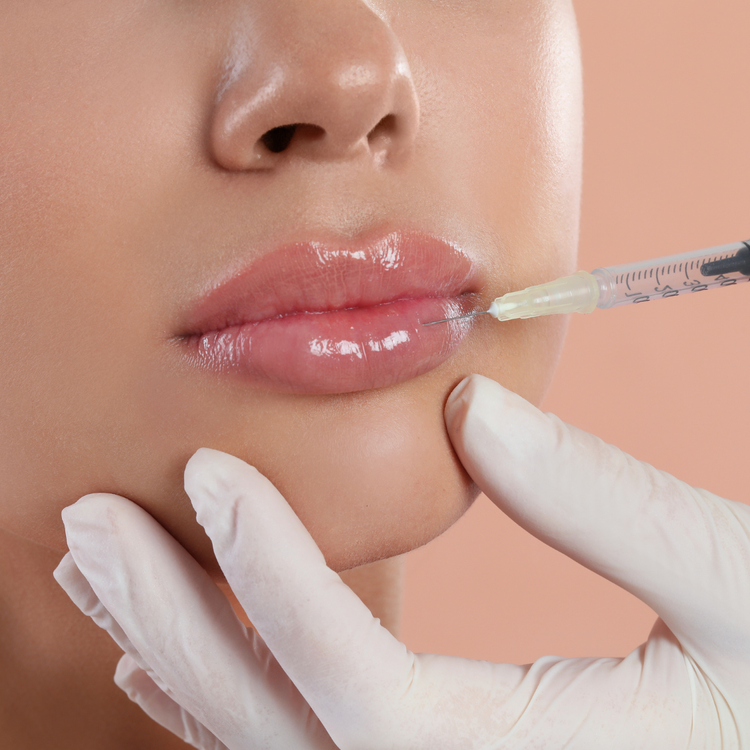 Dermal filler injections at YourSkinRN in Kitchener-Waterloo to restore volume and enhance facial contours.