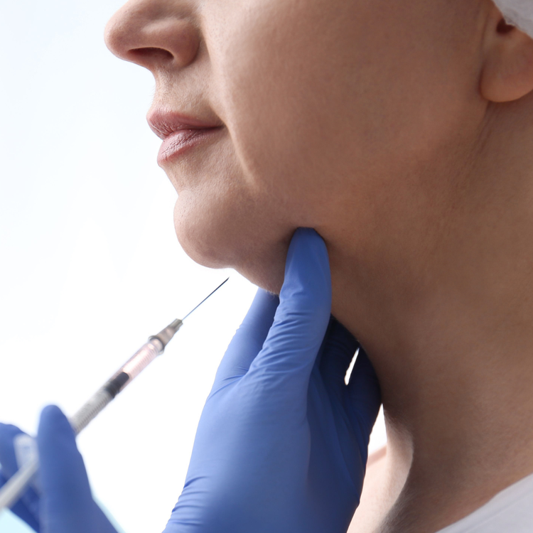 Belkyra deoxycholic acid injections for double chin reduction at YourSkinRN in Kitchener-Waterloo.