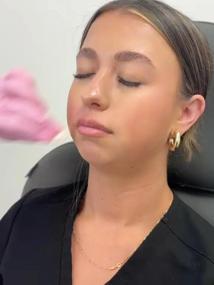 💋 LIP FLIP MAGIC at Luxus Aesthetics + Wellness by @luxus.by.lauranp 💫
Looking for a subtle, natural enhancement? A lip flip gently relaxes the upper lip to reveal more of your natural pout—no filler required! 👄✨
✅ Quick procedure
✅ Minima