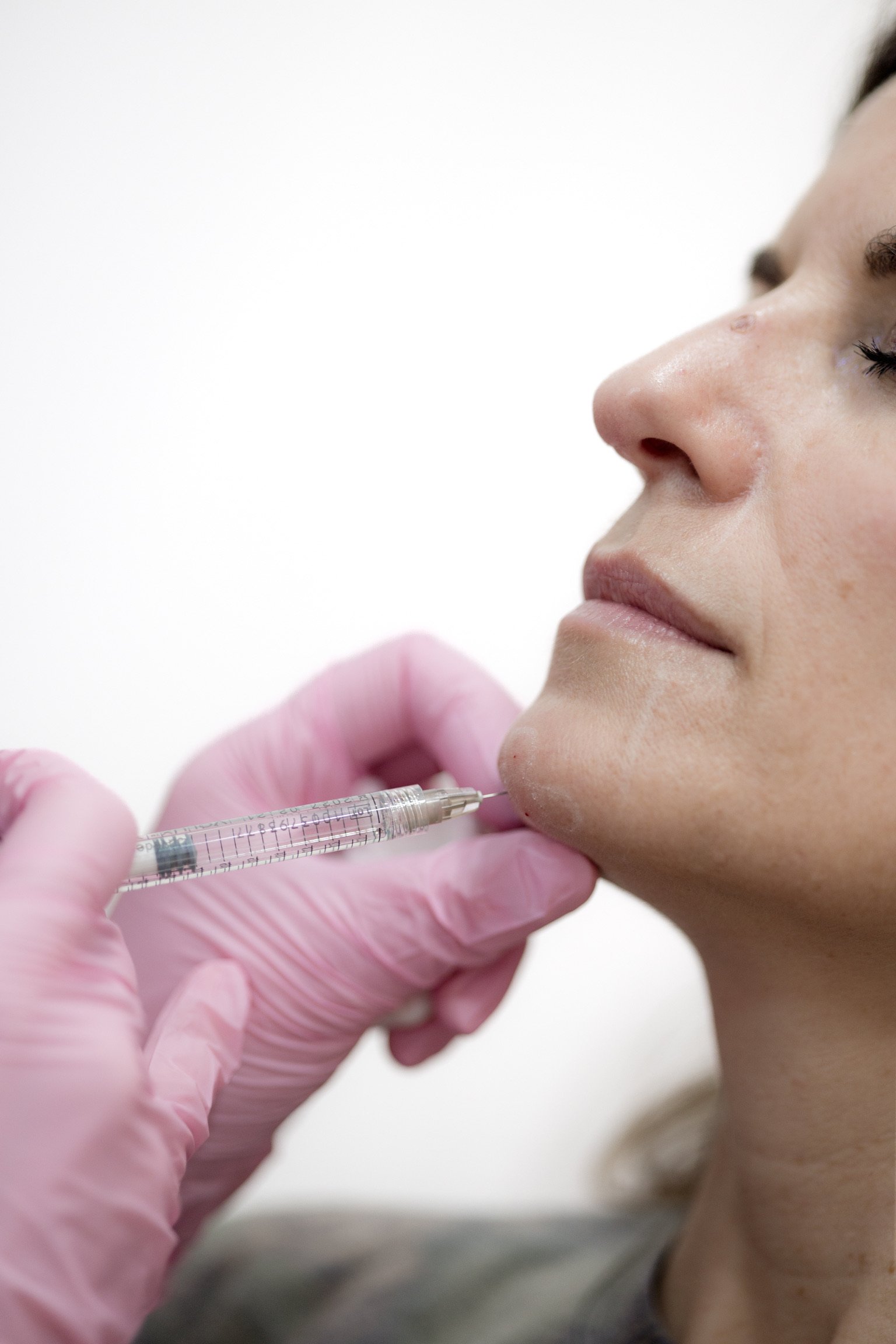 A woman receiving a cosmetic injection in her face from a medical professional wearing pink gloves.