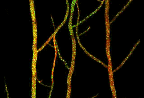 Mycellium of our Bodies