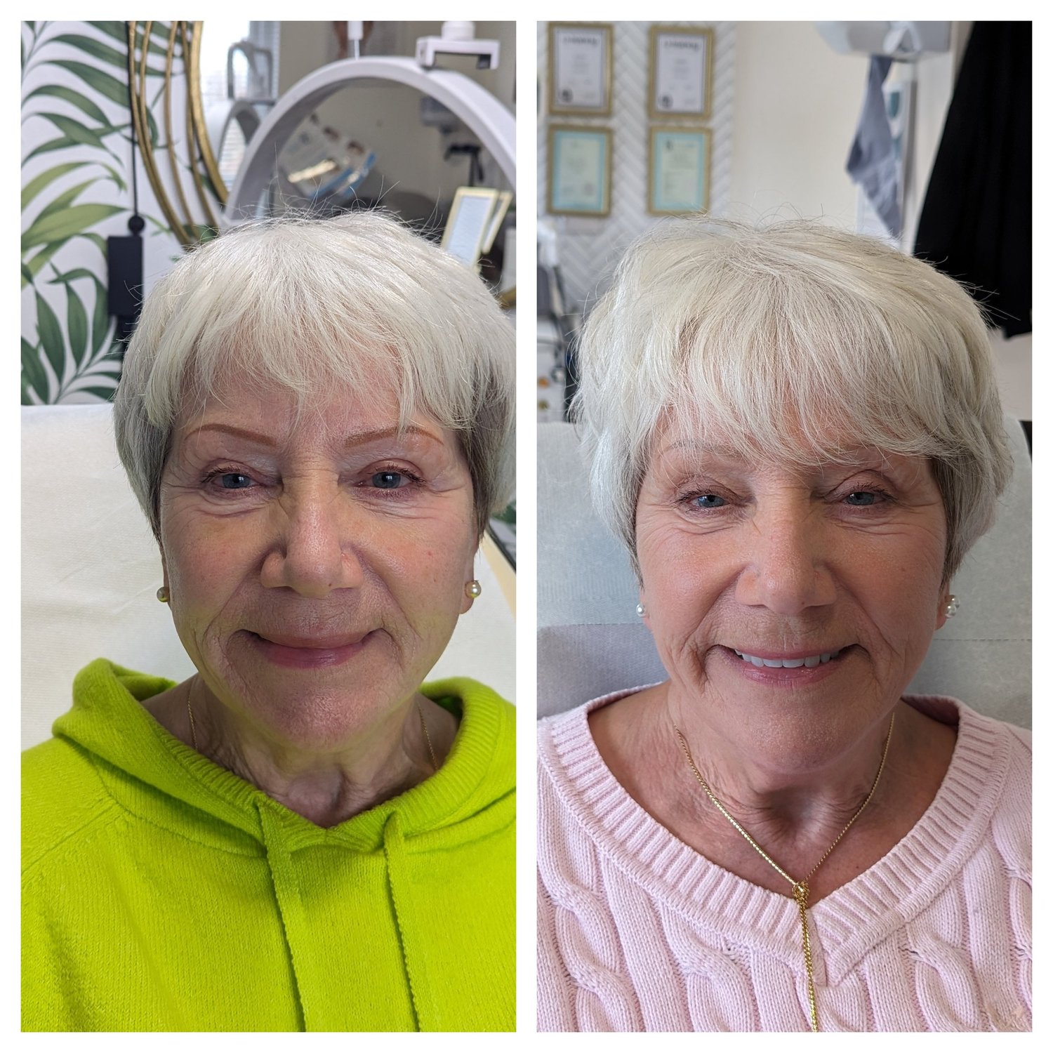 Bright, refreshed, natural-looking skin