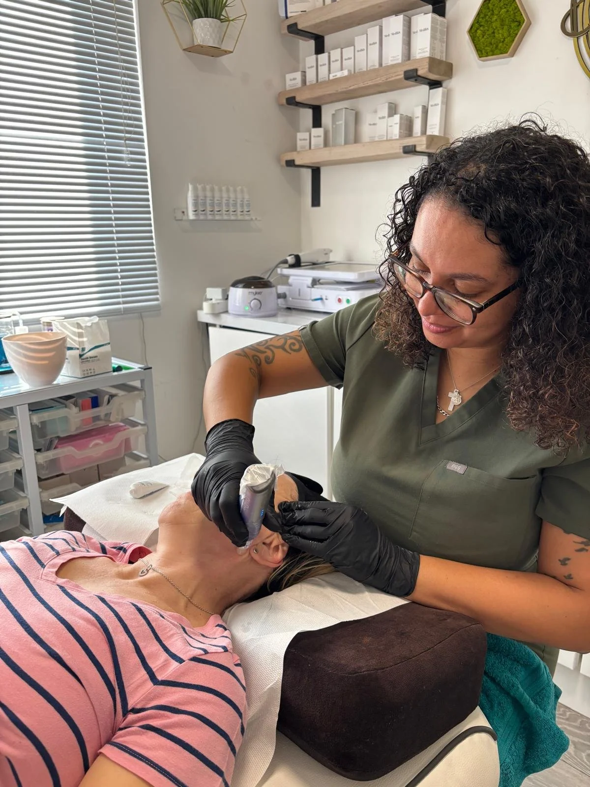 Exosomes and Microneedling Bromley