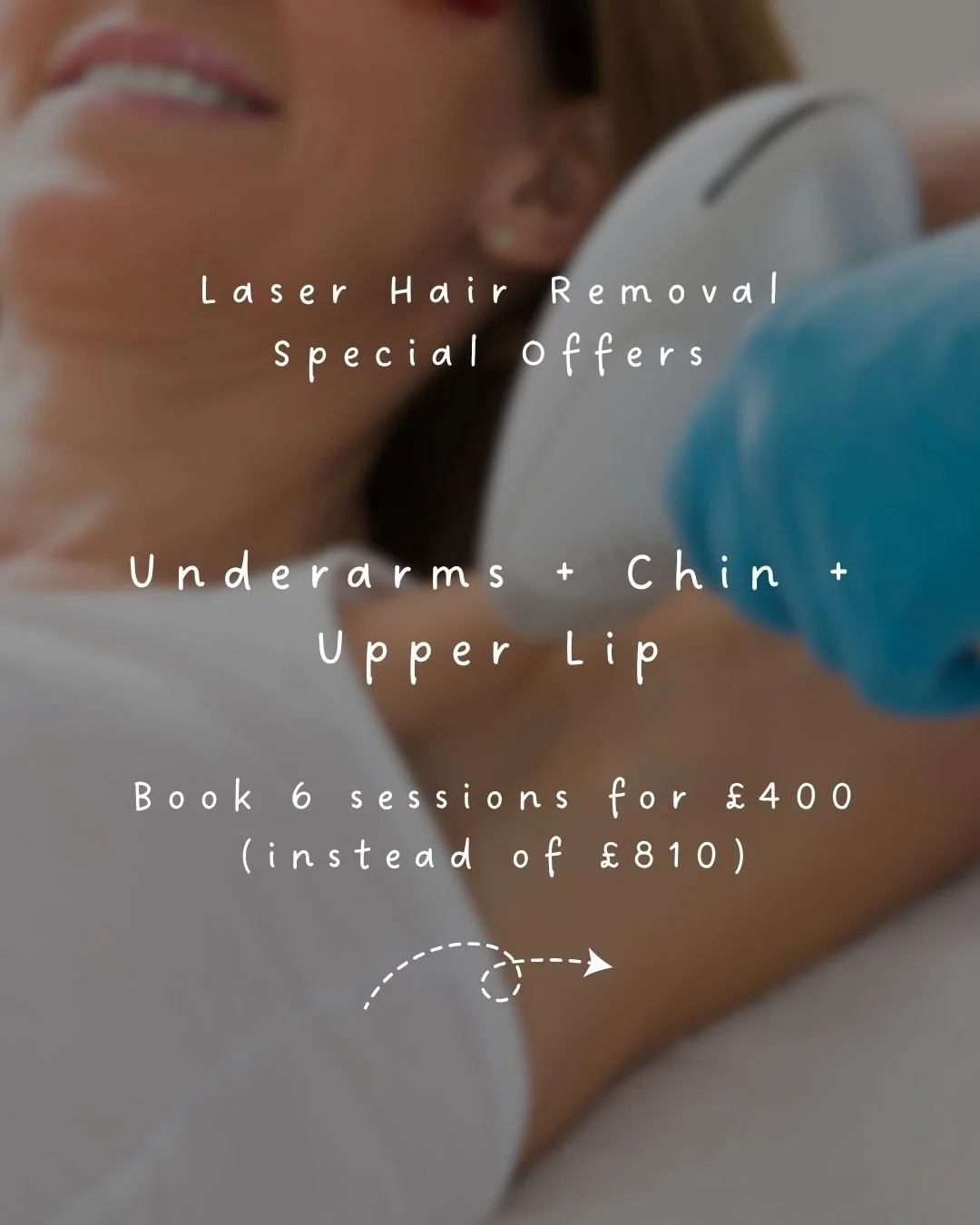 We&rsquo;re excited to offer a limited number of discounted 6-session laser hair removal packages with Nayle, available on Thursdays! 

Underarms + Chin + Upper Lip (6 sessions)
Was &pound;810 &rarr; Now &pound;400*
 
Underarms + Half Leg (6 sessions