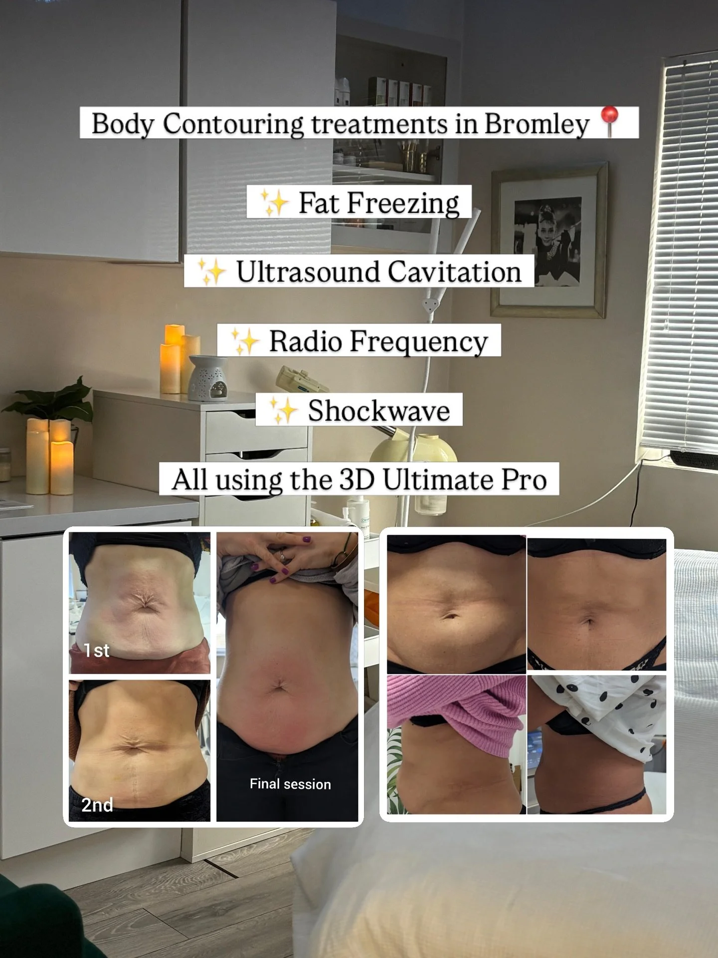 Book a body contouring consultation with Rhea at our Bromley clinic &amp; receive a personalised plan + special treatment rate for a limited time only! Send us a DM to learn more. 📲