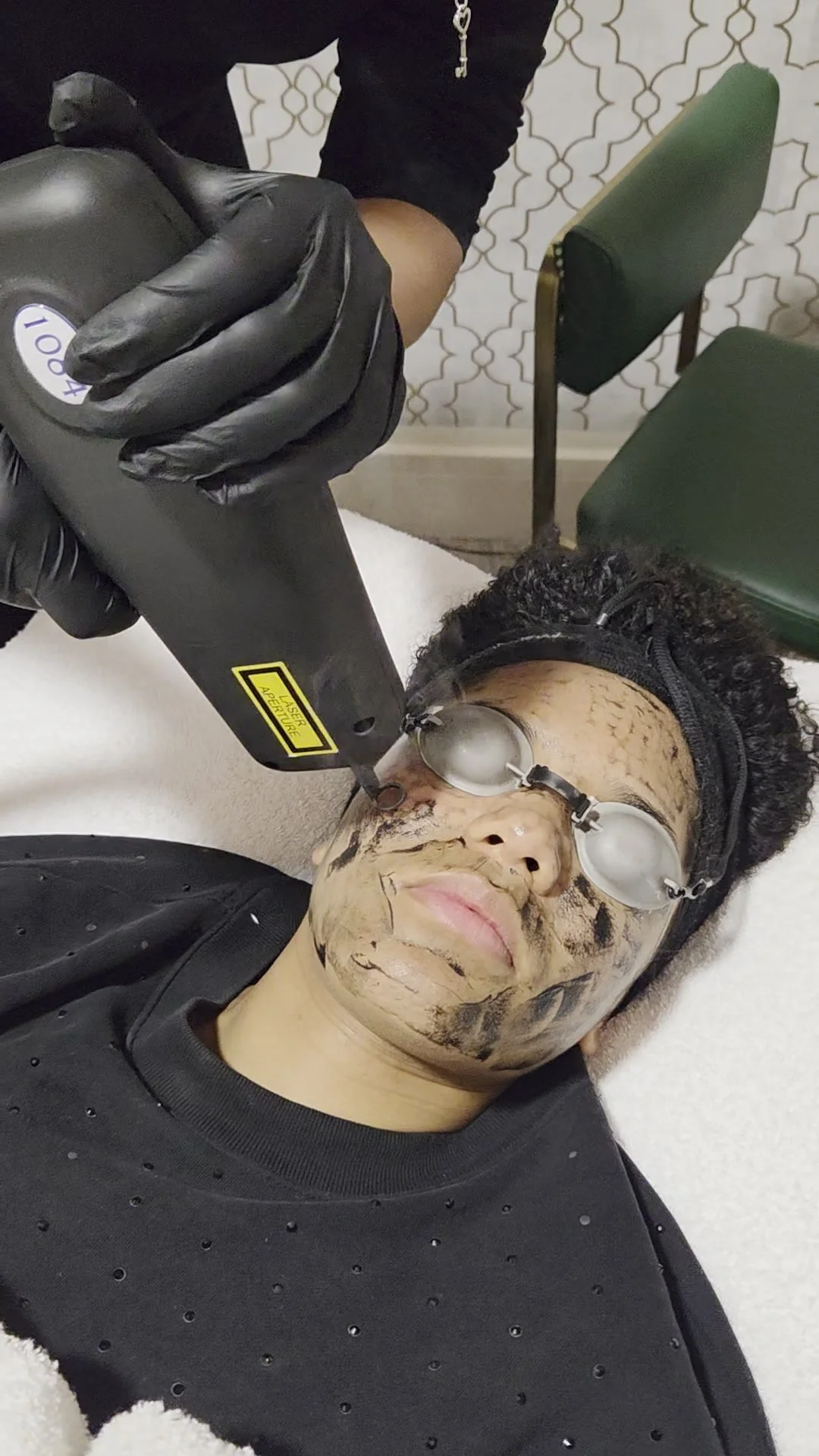 Carbon Laser Facial