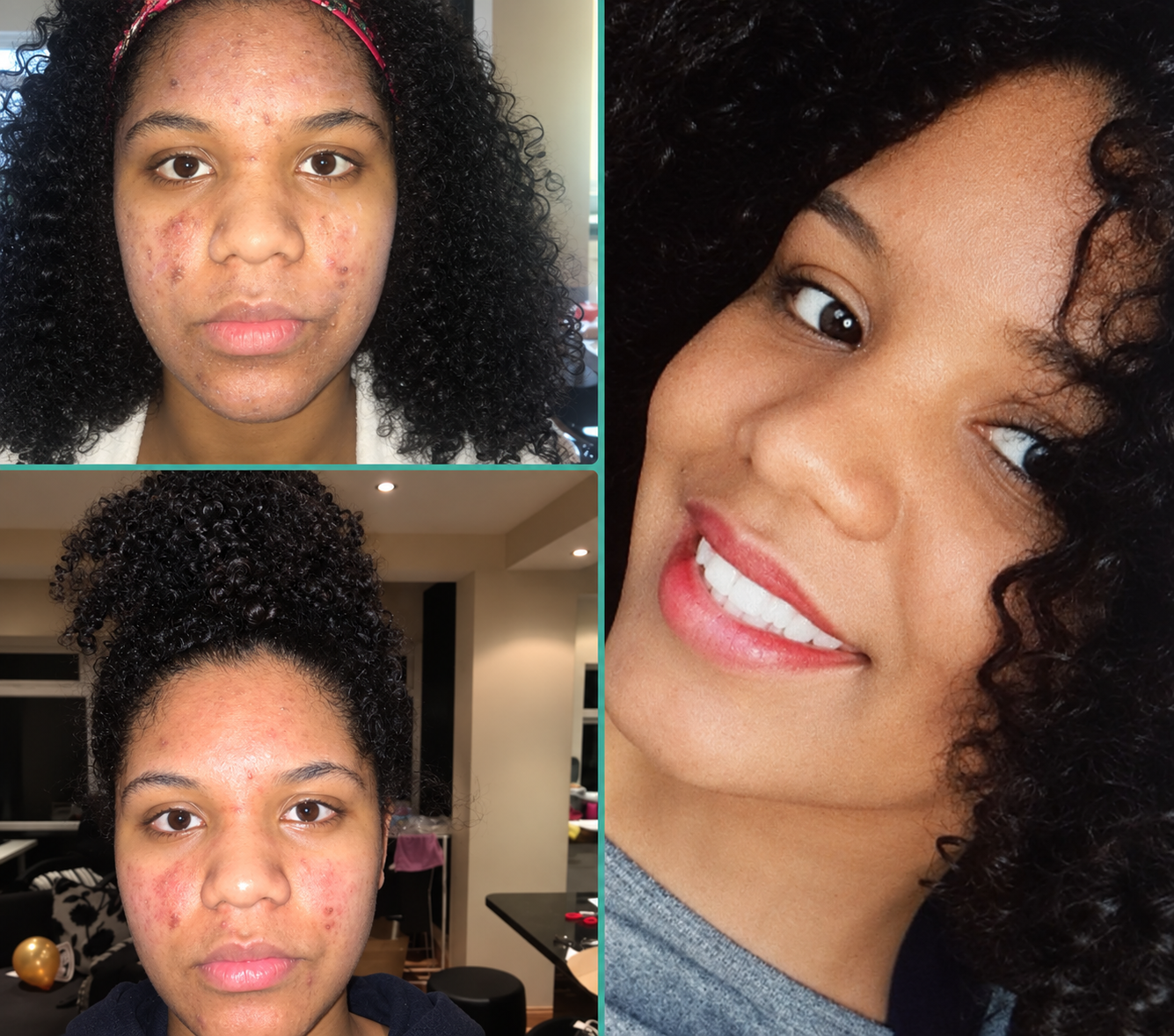 Cosmelan Peels