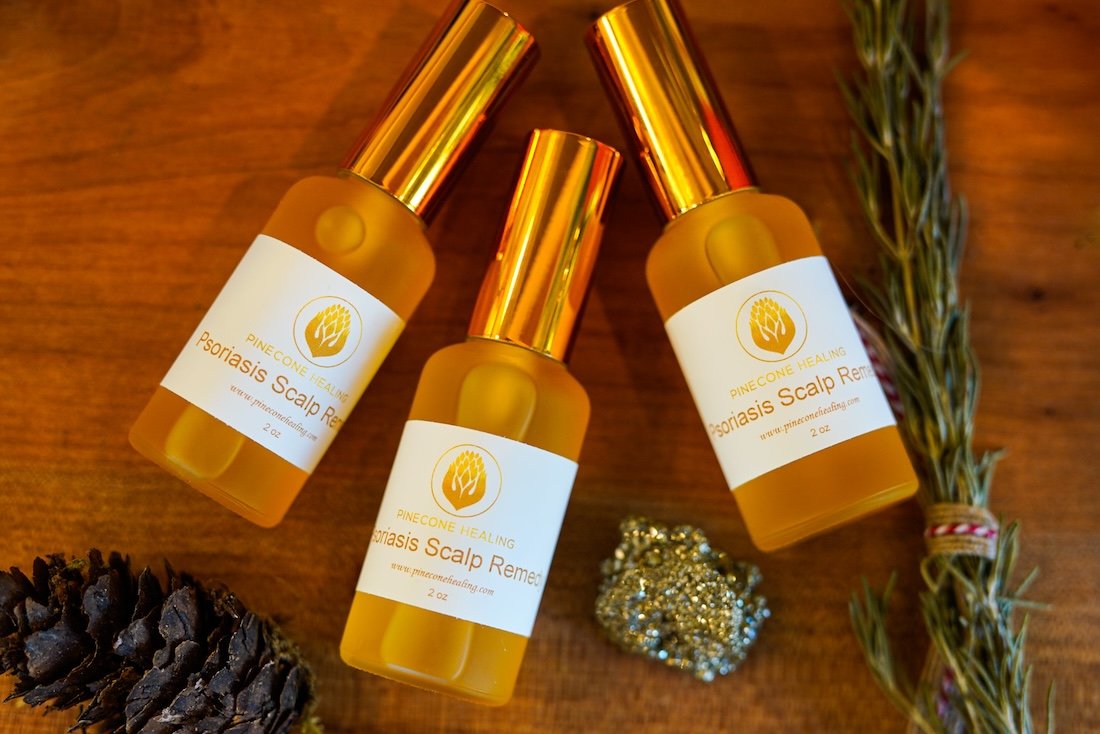 Psoriasis Scalp Remedy