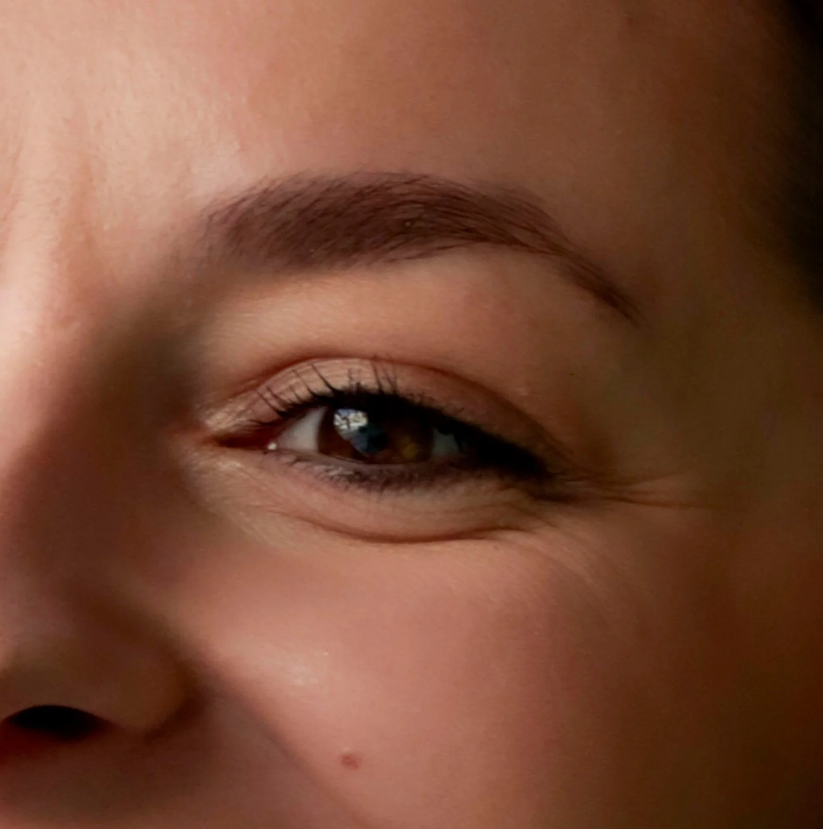 Mole on Face Mole Removal