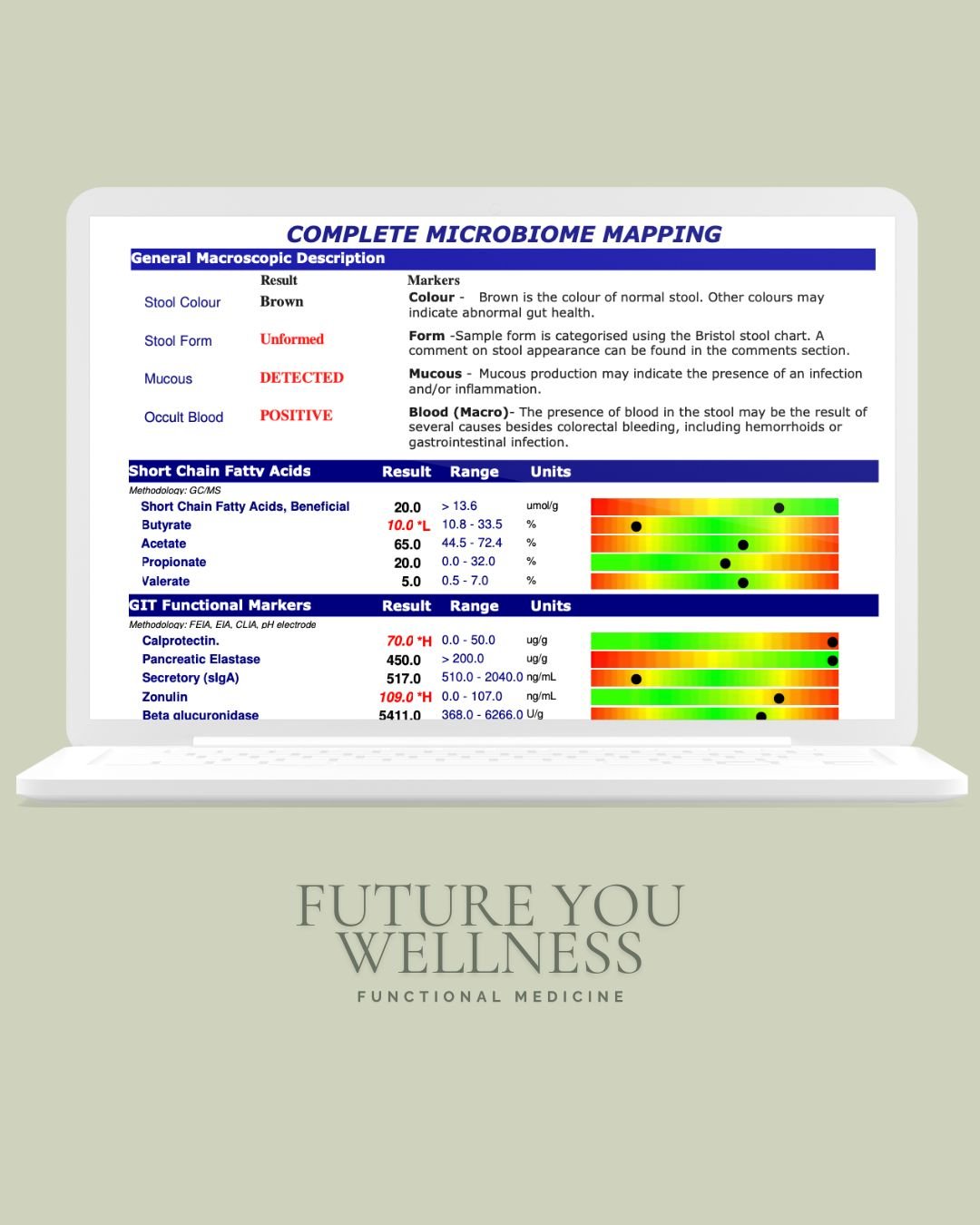 Laptop displaying microbiome mapping report with test results and analysis, placed on a light green background with the text 'Future You Wellness' and 'Functional Medicine' below the screen.