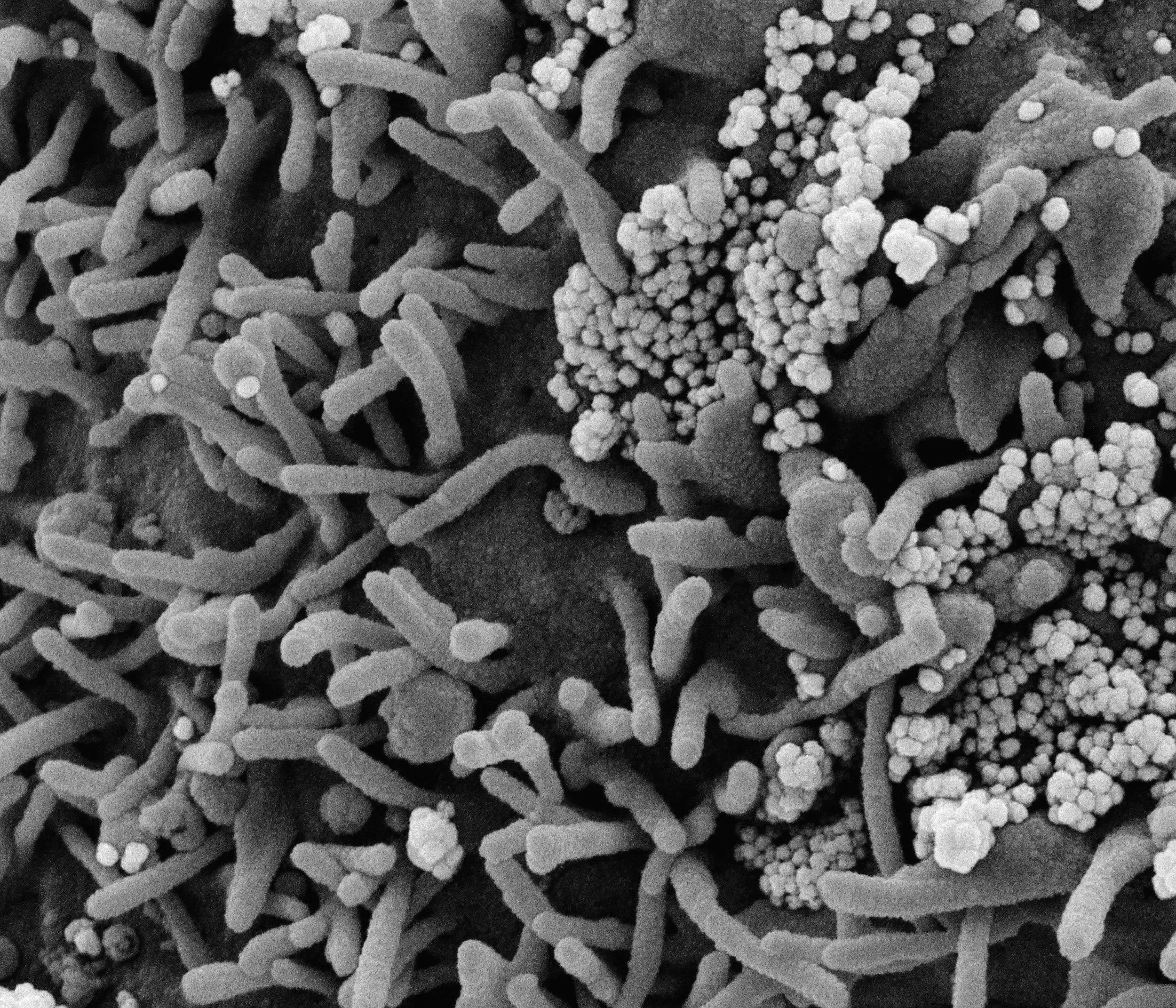 Close-up of a rough textured surface with elongated rod-shaped structures and rounded clustered formations, likely microscopic or at a high magnification.