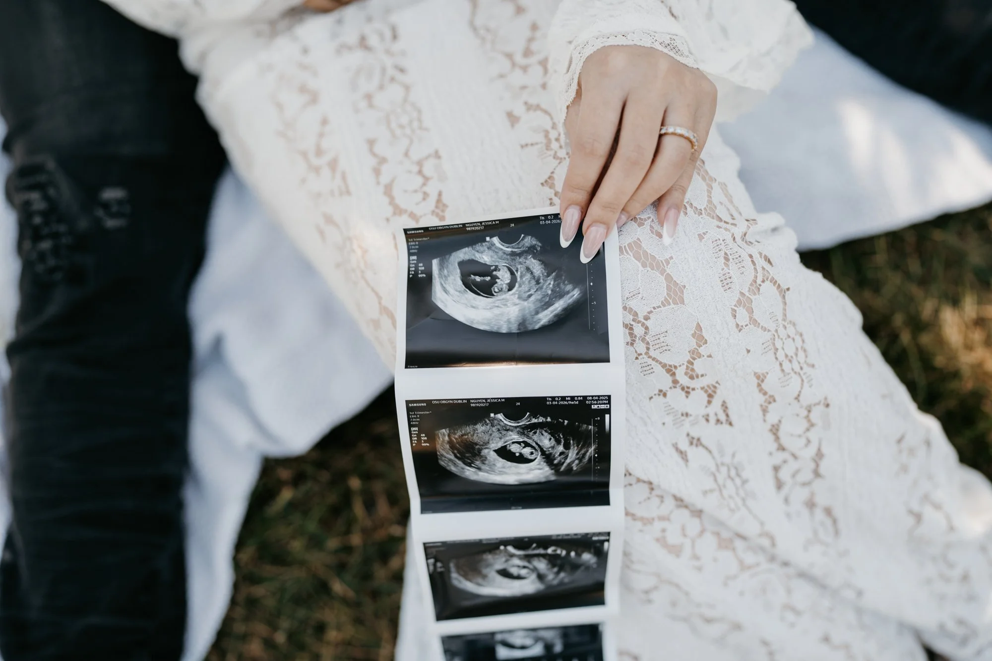 A woman who is wearing a white lace dress is sitting outside on the ground, holding an ultrasound image strip showing multiple sonogram scans of a developing fetus.