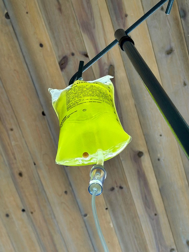 Banana bag IV drip for hangover