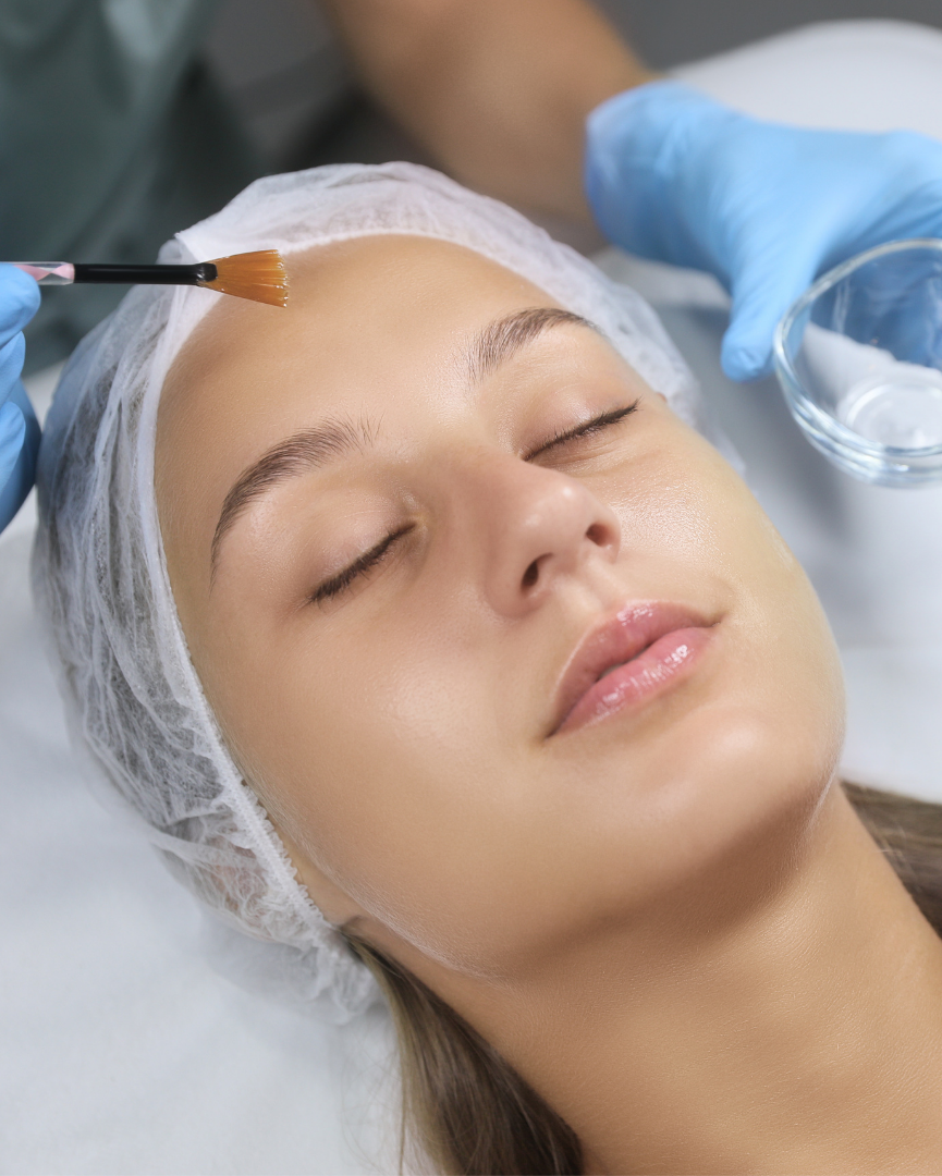 Medspa in Los Angeles, CA 90028 l VI Peel Near Me