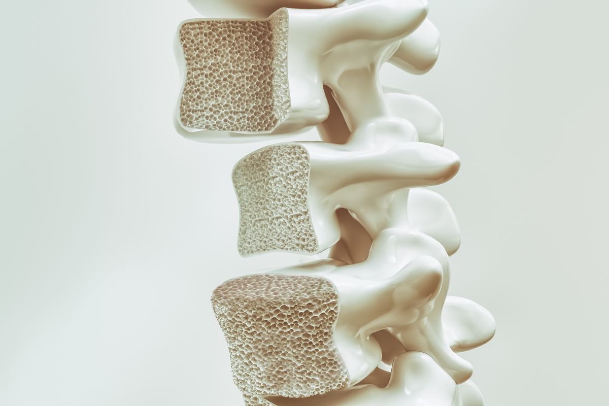 Building Stronger Bones: Understanding Bone Mineral Density