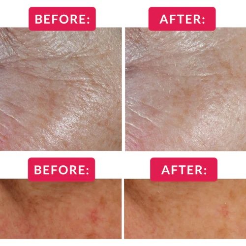 HLTcarouselimagestemplate_eyecream7_a368f609-85ae-4cae-b491-a126376e5bc2_500x500_crop_center.jpeg