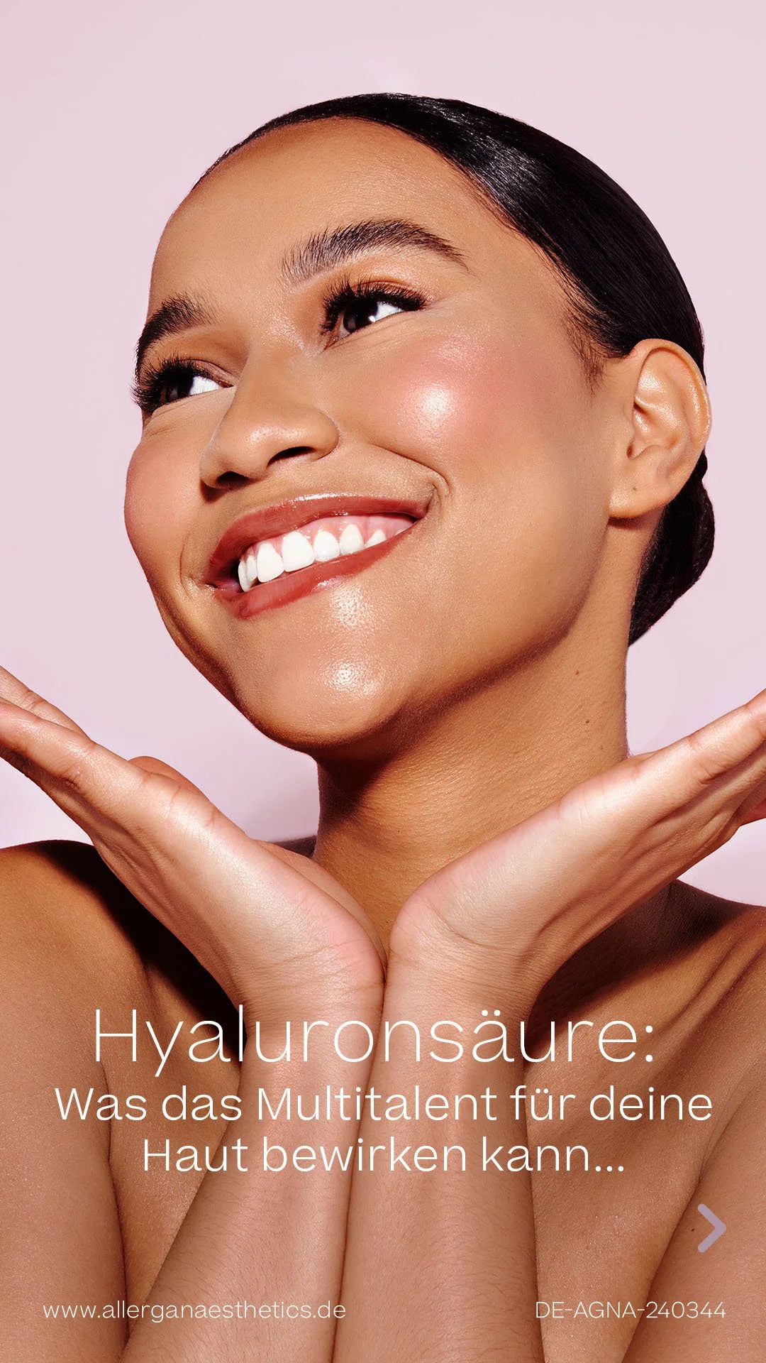 Story - Hyaluronsäure Juvéderm 1.jpg