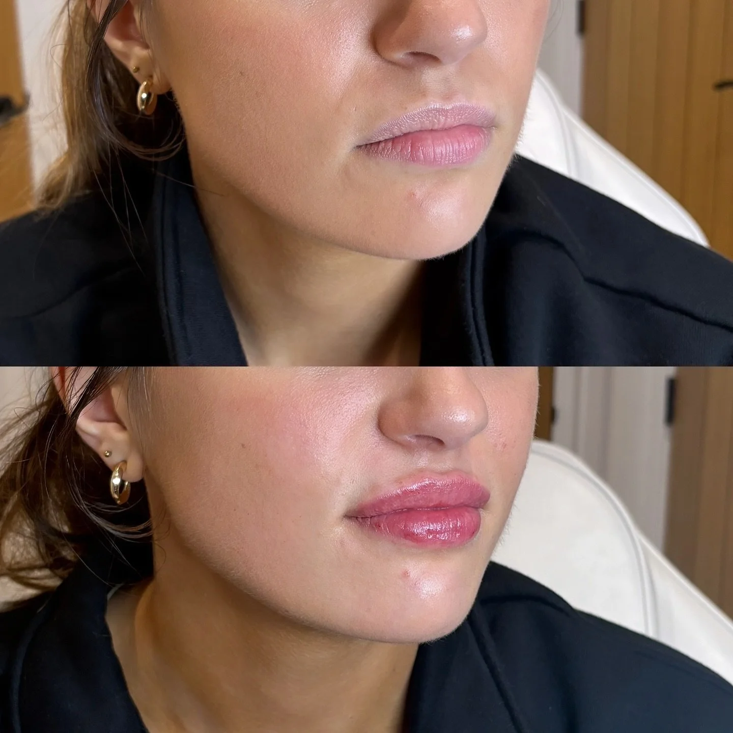 Chefs kiss 💋 

Using stylage lips plus for plumper more hydrated lips @vivacy_uk