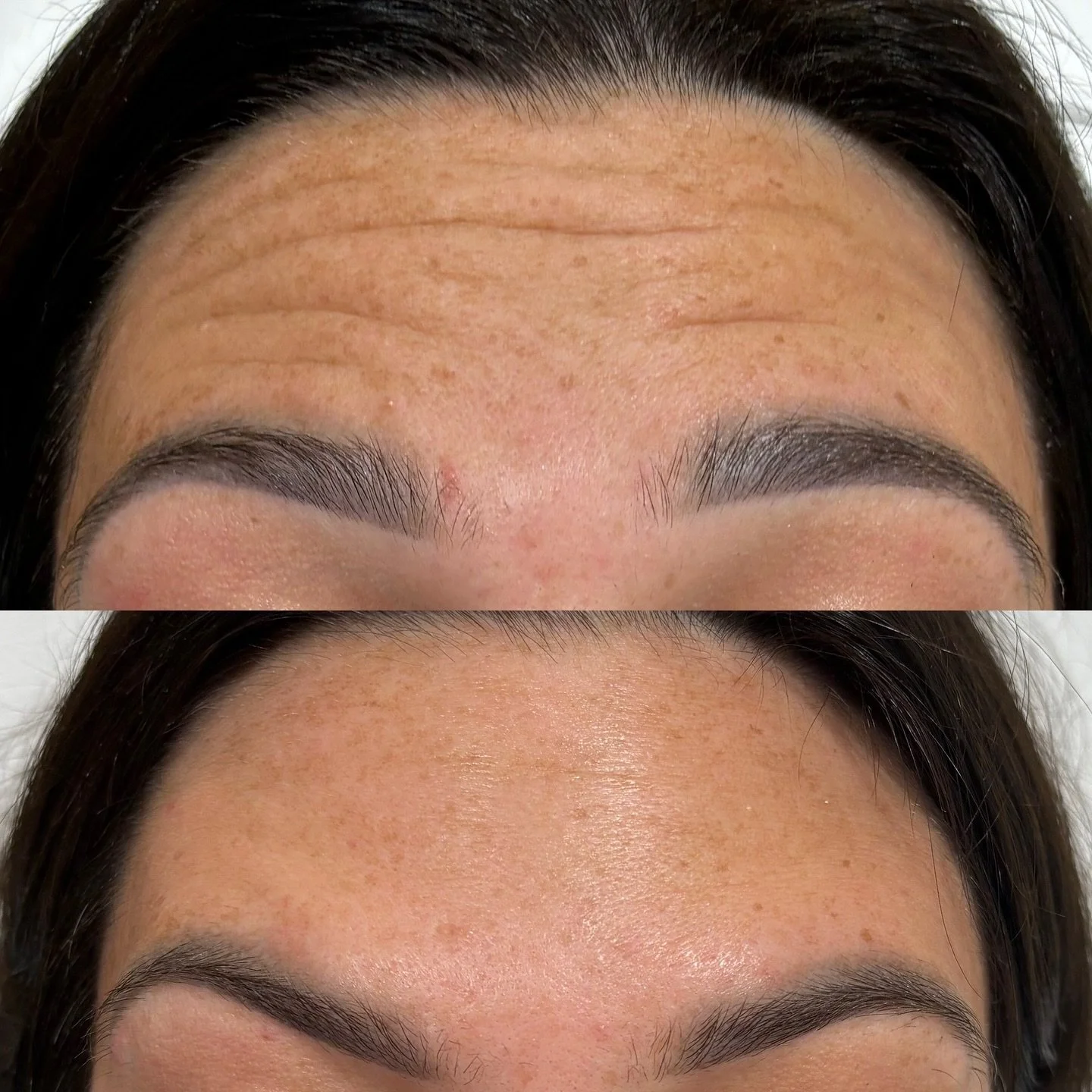 At HCM Elegance, we offer a range of aesthetic treatments each designed with you in mind. Whether you&rsquo;re looking to enhance your natural beauty, prep for your wedding day, boost your skin&rsquo;s glow, or simply feel more confident in your own 