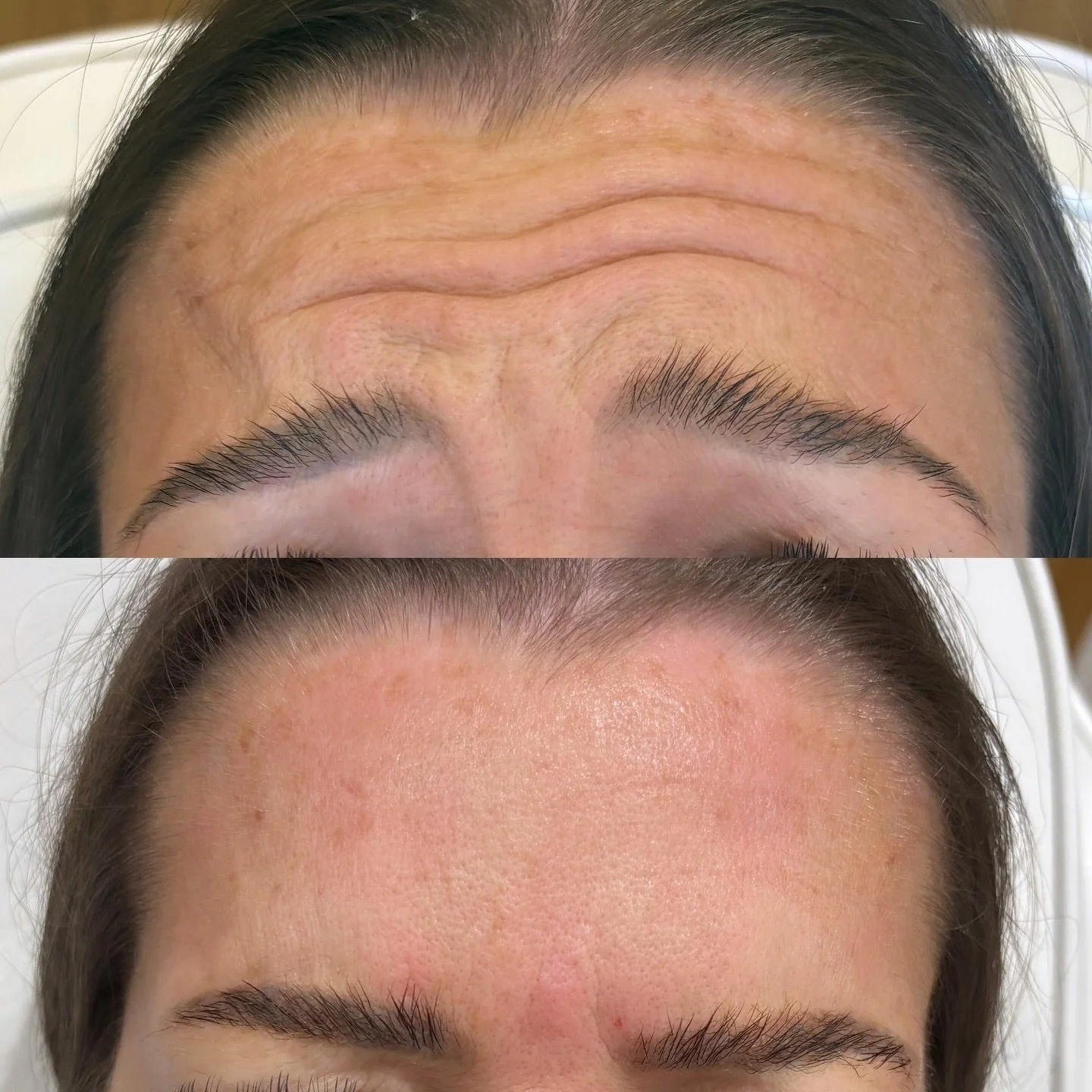 Remaining and final appointments for 2025 for consults available on the link in bio! 

Don&rsquo;t leave it too late!