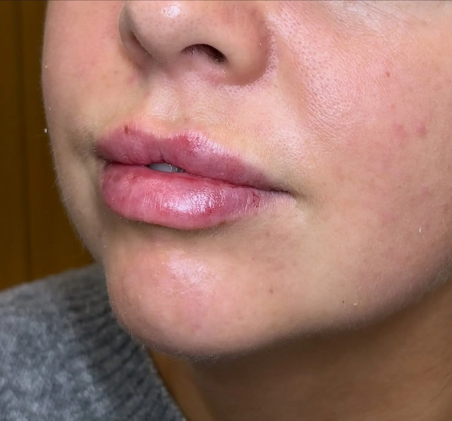 Pout ready this season 👄