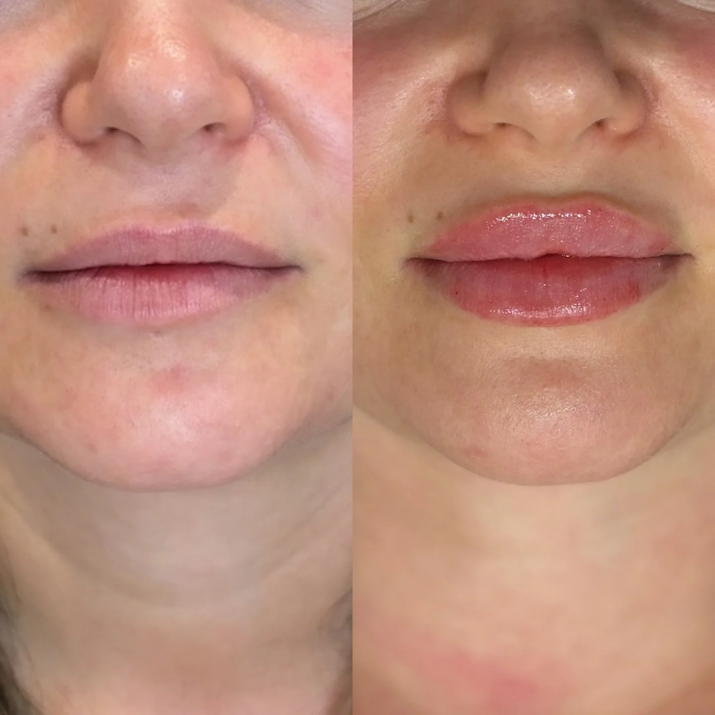 X 2 tweakments done here 💋