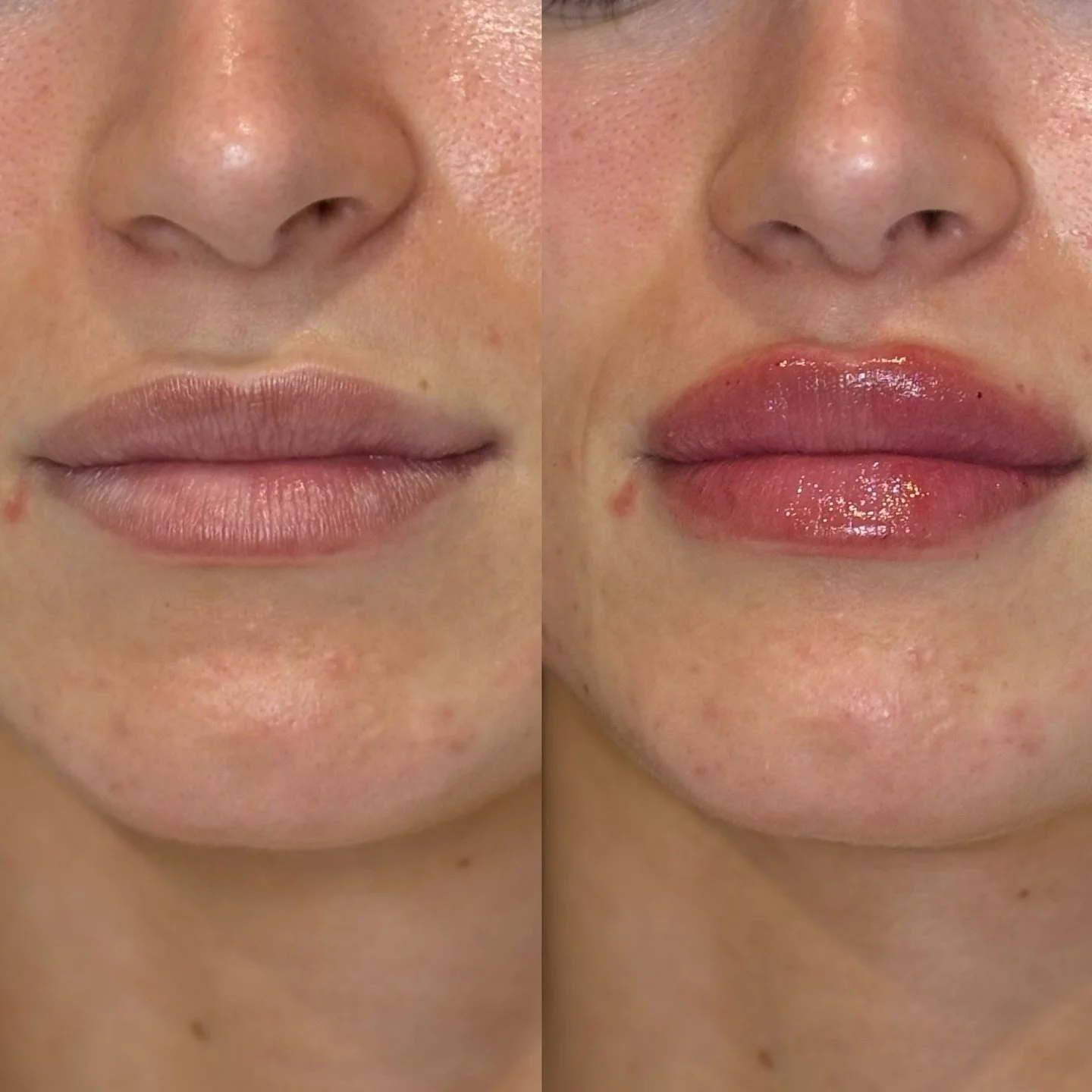 Subtle tweakment to refresh and hydrate 👄