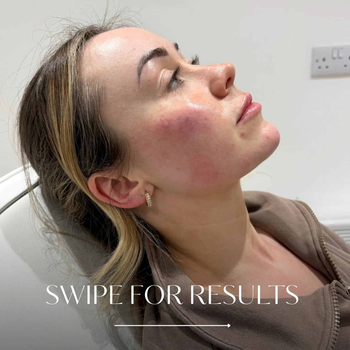 Tweakments = small, strategic treatments that make a big difference
 
May availability limited! 

Link in Bio to book ❤️