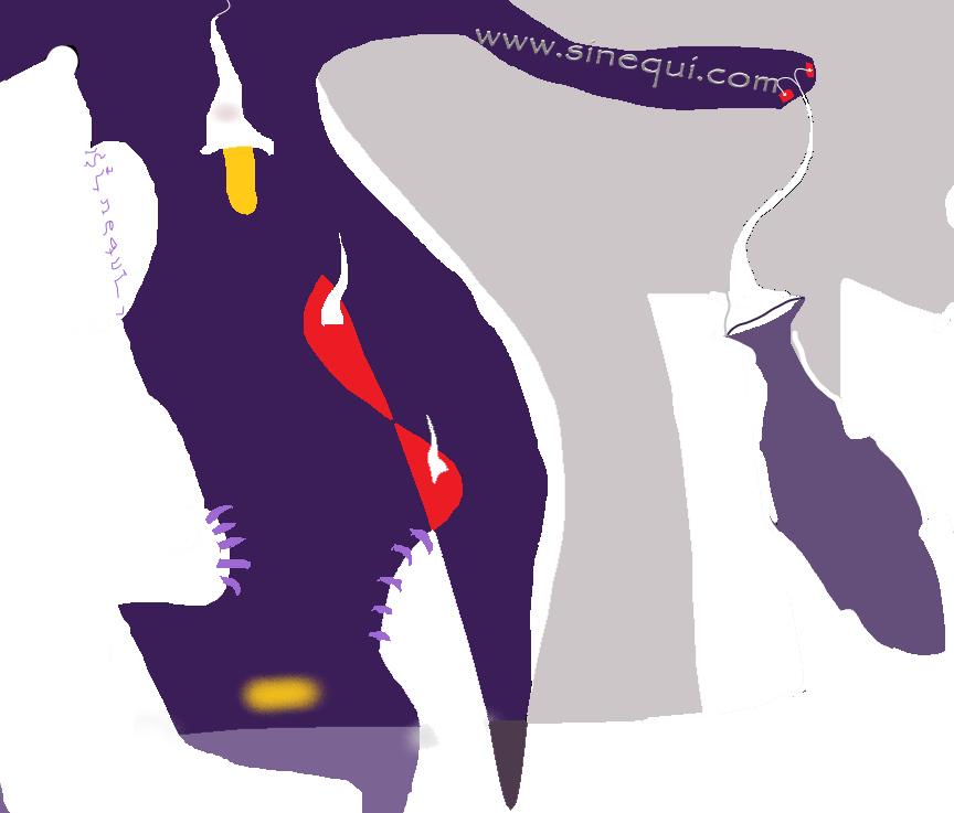 Ánforo cueva y botín de punta