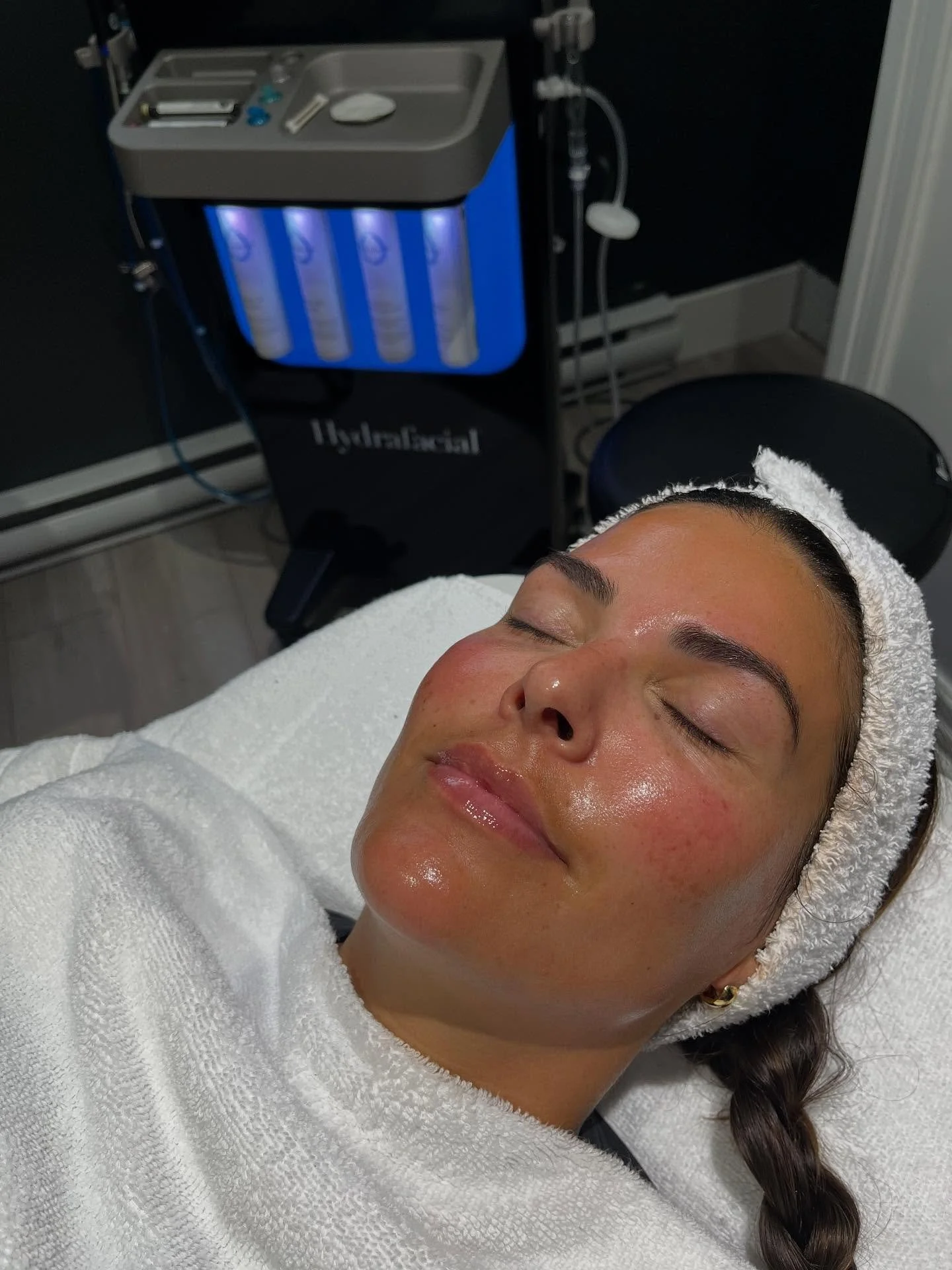 That glow though #hydrafacial #hydrateyourskin  #hydrafacialtreatment #royalbaycolwood