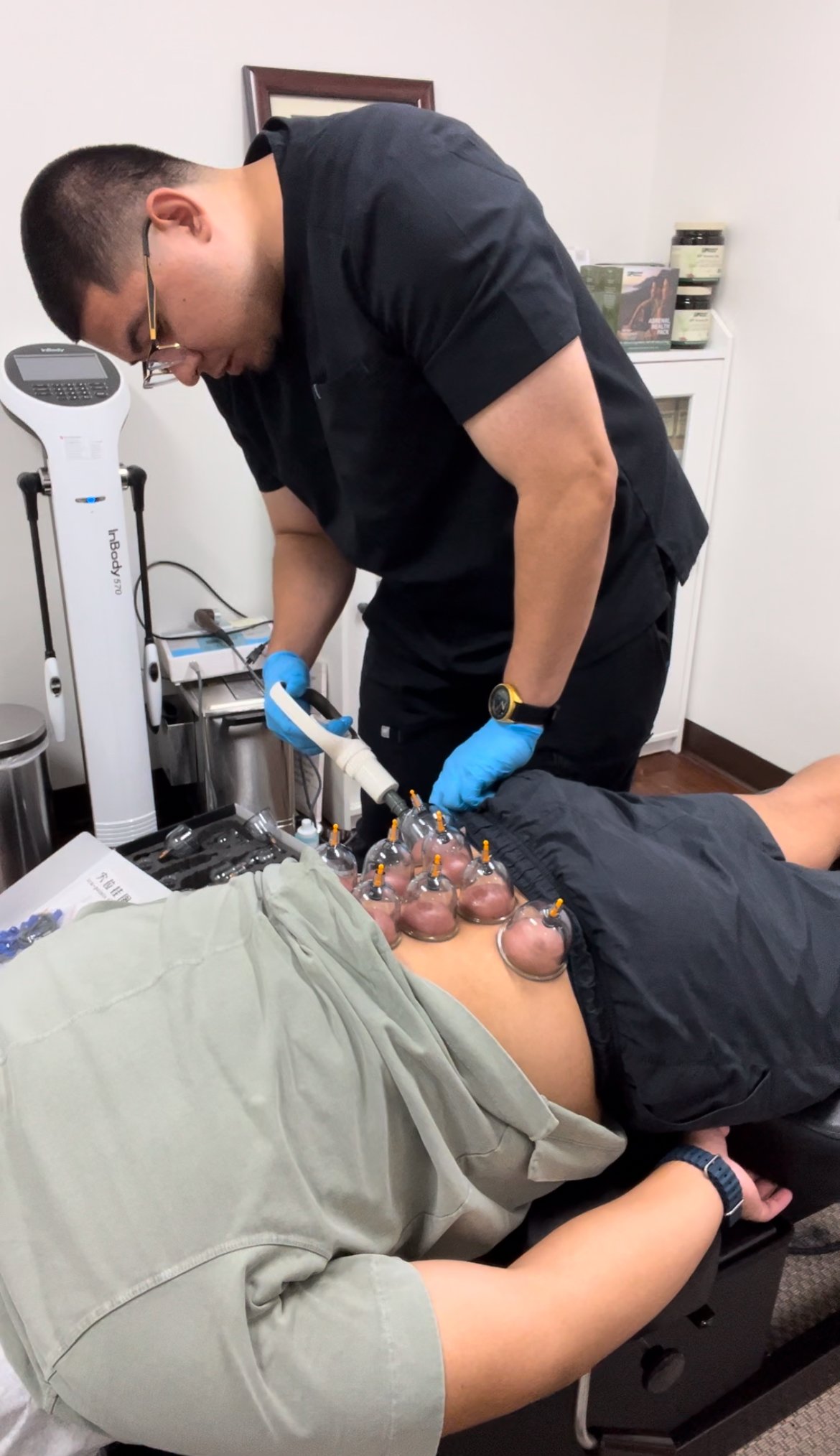 A person receiving cupping therapy on their back with multiple cups attached. A healthcare professional uses a device to create suction under the cups.