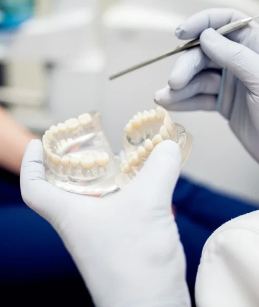 Single tooth dental implant restoration in irvine