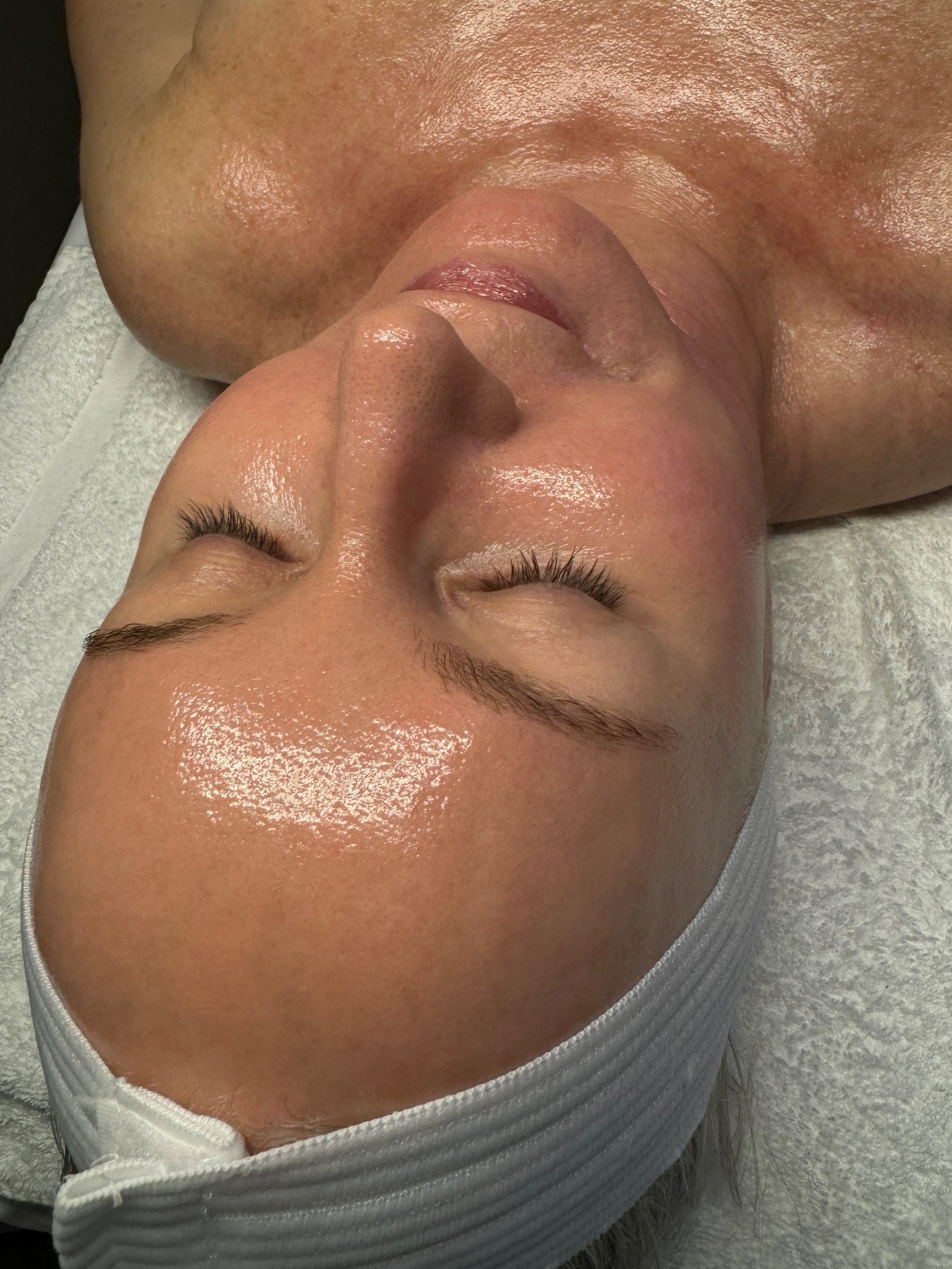 HydroGlow Facial