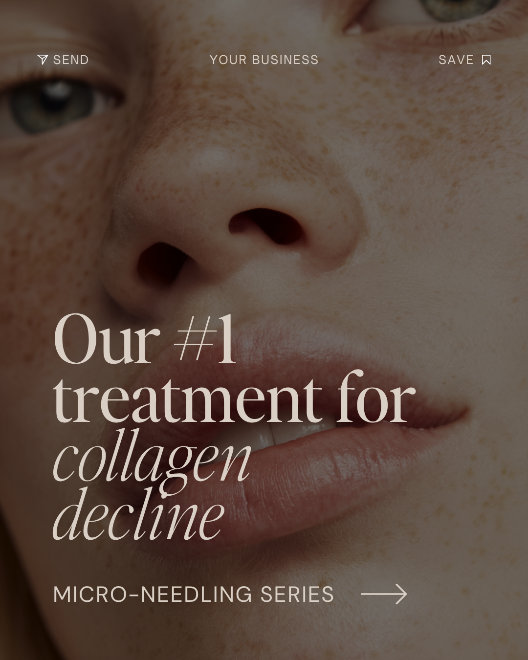 TDC Carousel Micro-needing and collagen (1).png