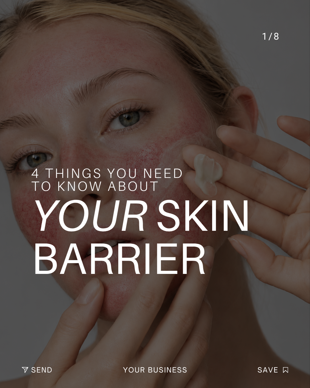 TDC Carousel 4 Facts about the Skin Barrier.png