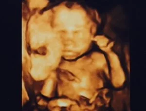 fertility13.jpg
