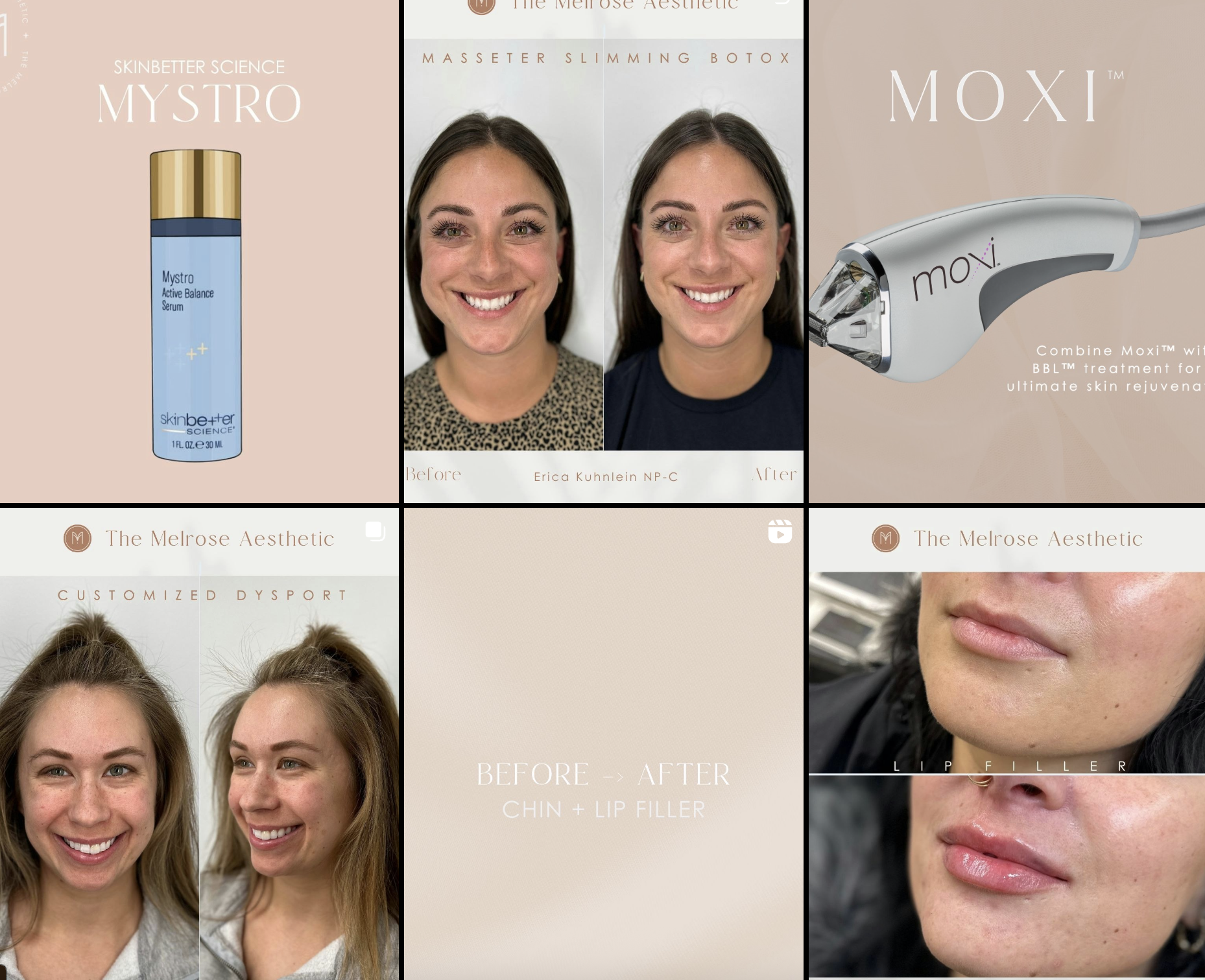 Collage of aesthetic treatments, including skincare products, before and after facial photos, and cosmetic procedures like lip filler and chin enhancement.