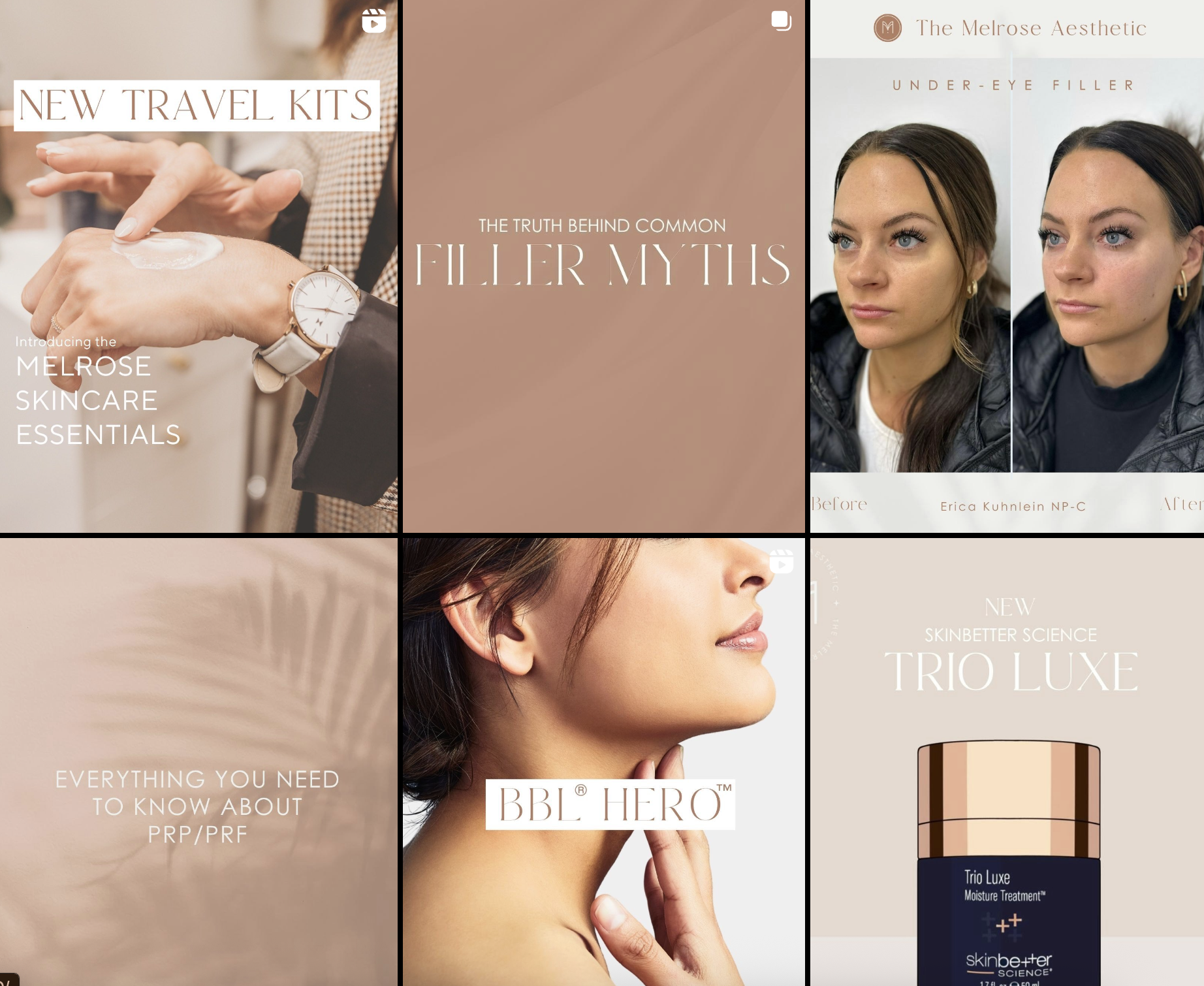 Collage of skincare and aesthetic treatment promotional images including skincare kits, under-eye filler before and after photos, a woman with a radiant face, and a skincare product called Trio Luxe.