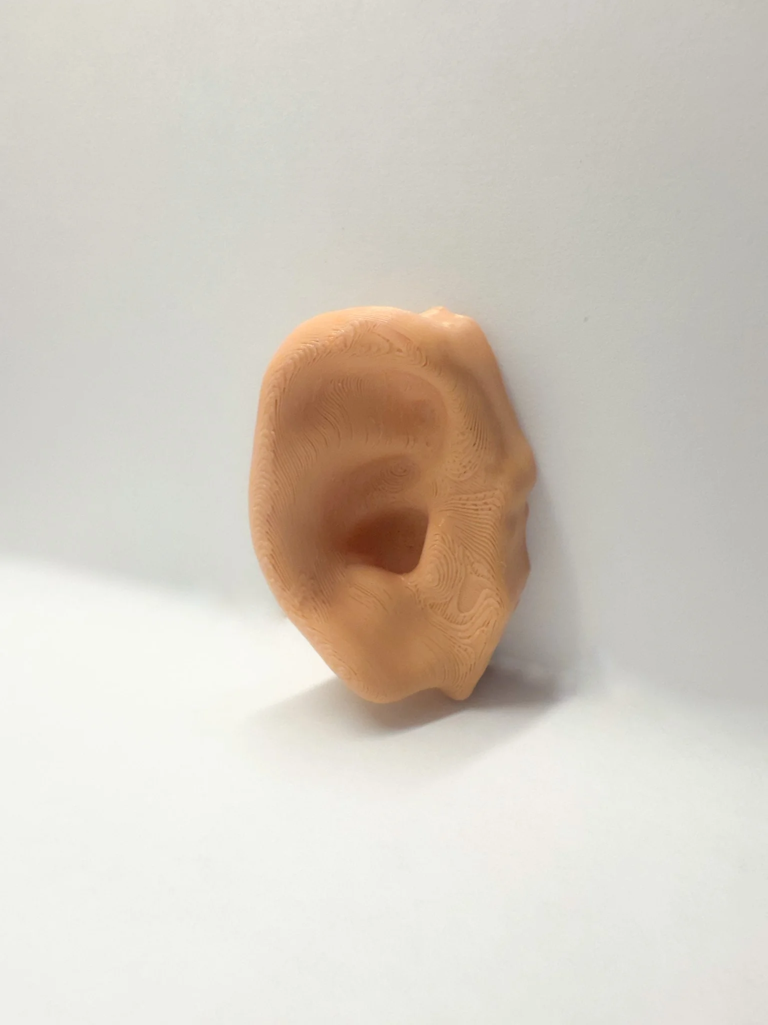 Aurius Prosthetics - Prototype 3