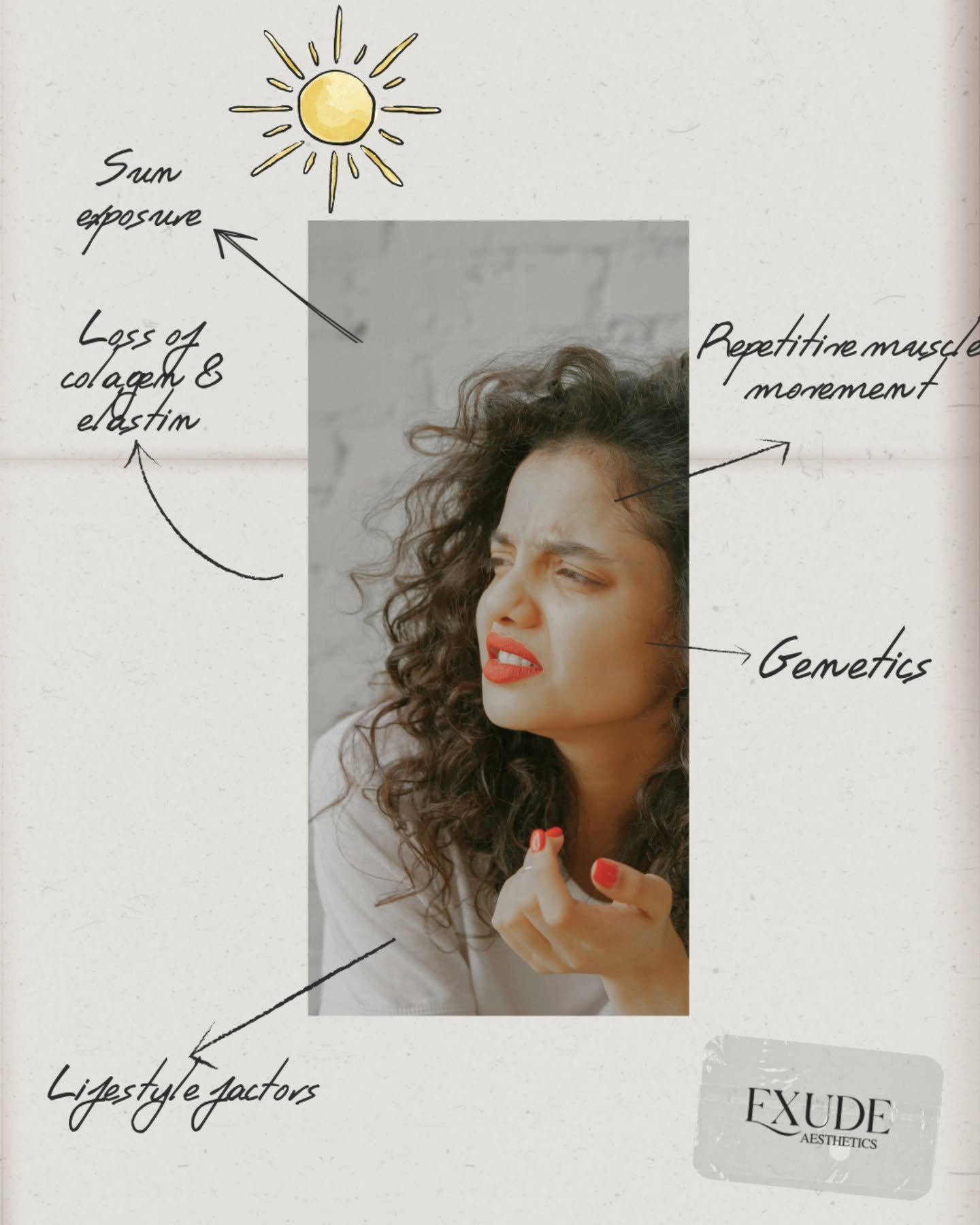 ✨️How wrinkles develop?✨️

Wrinkles are a normal part of ageing and develop due to several factors:

1️⃣ Repetitive muscle movement &ndash; Facial expressions like smiling, frowning, and squinting create lines over time.
2️⃣ Loss of collagen &amp; el