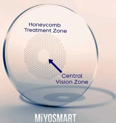 Myopikontroll er et stort tema, og nå kommer også glassprodusentene med hver sine løsningsforslag. Og vet du hva? De hjelper.