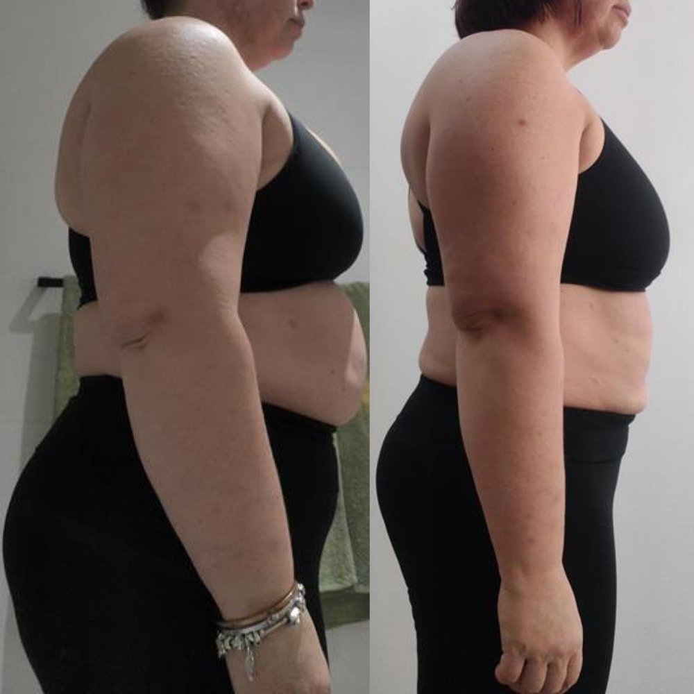 Chantel’s before and after transformation