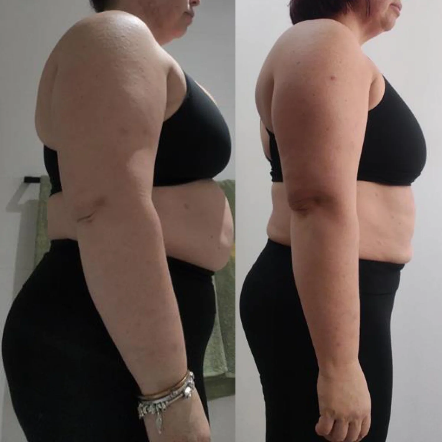 Chantel client transformation