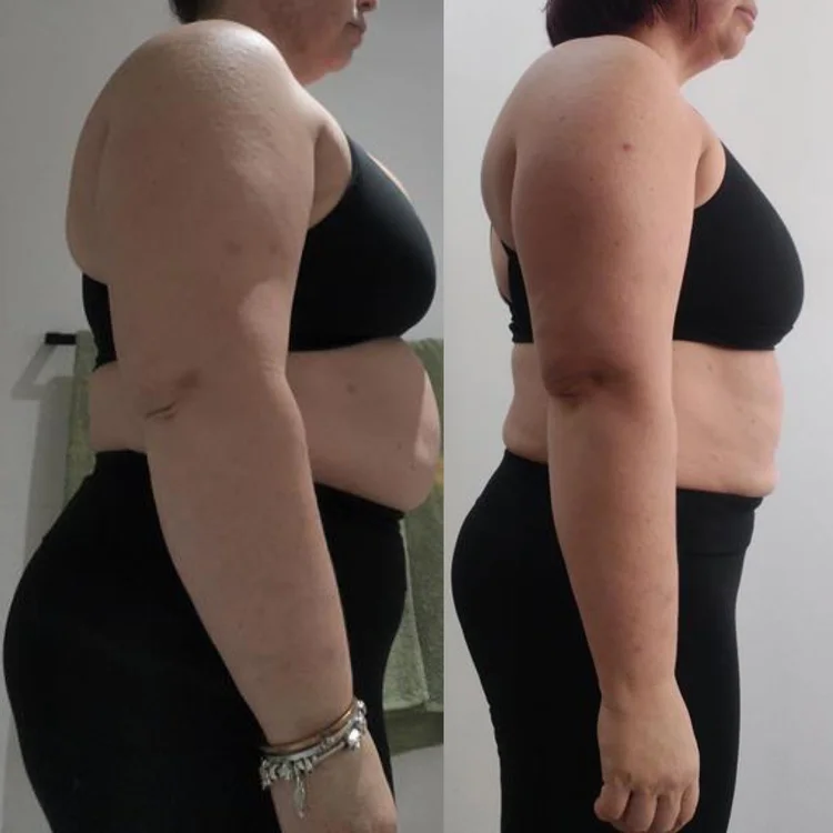 Chantel progress photo