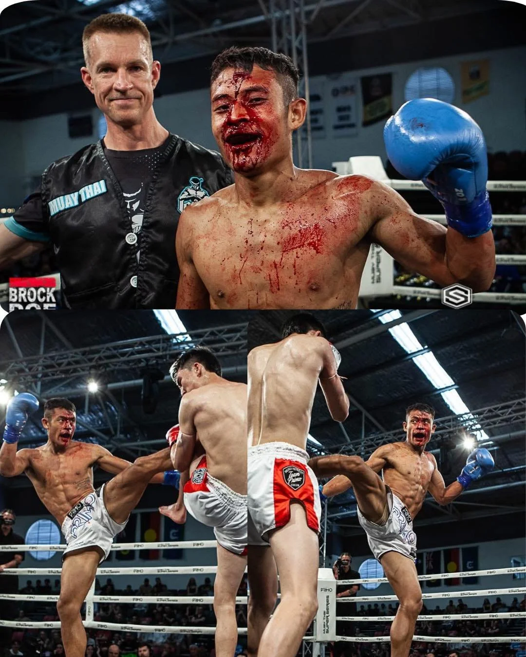 Not everyone understands this life.

The sweat you don&rsquo;t see.
The blood you can&rsquo;t hide.
The tears no one talks about.

Fighting isn&rsquo;t just what happens in the ring.
It&rsquo;s early mornings.
It&rsquo;s saying no when everyone else 