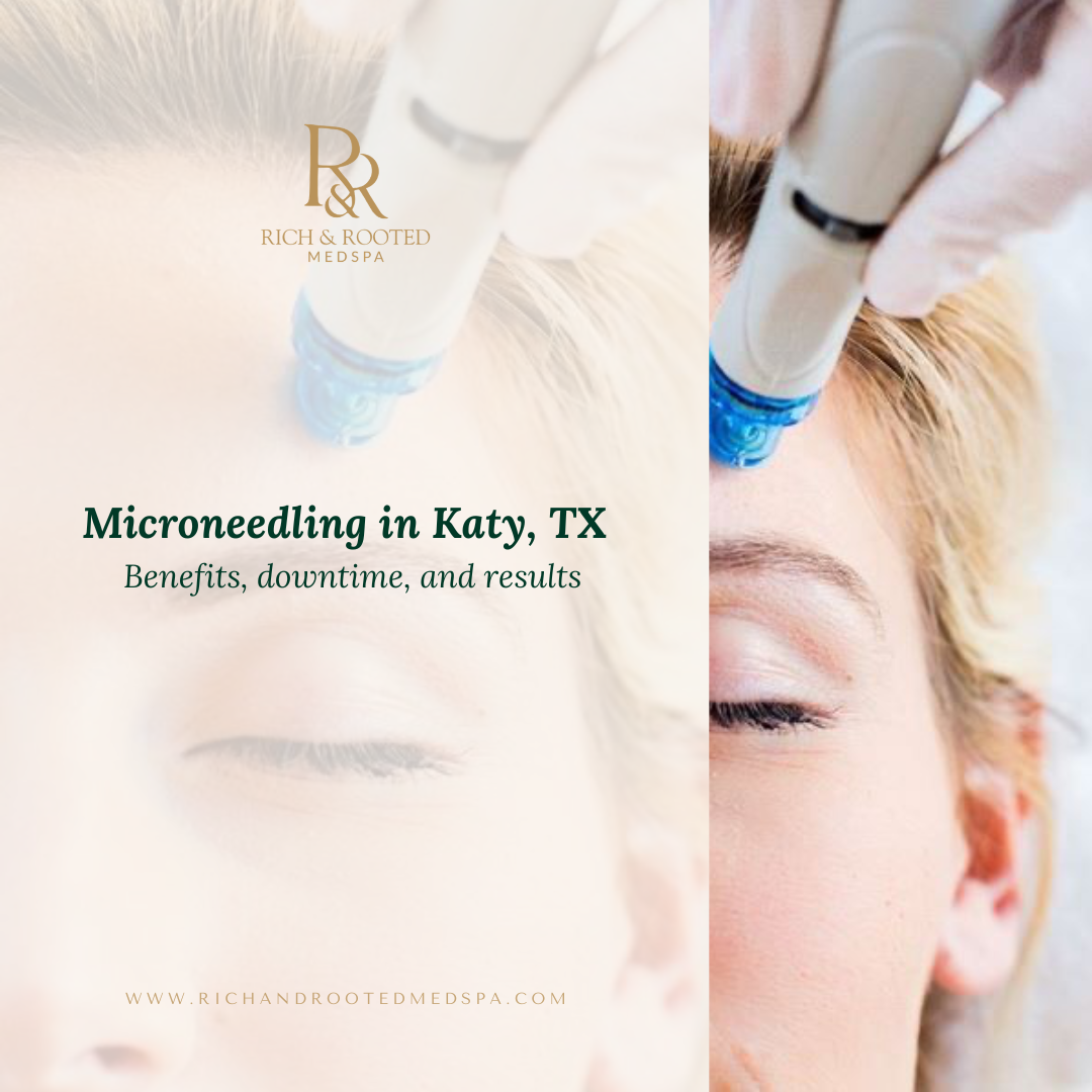 Microneedling treatment for skin rejuvenation at Rich & Rooted Medspa in Katy, TX