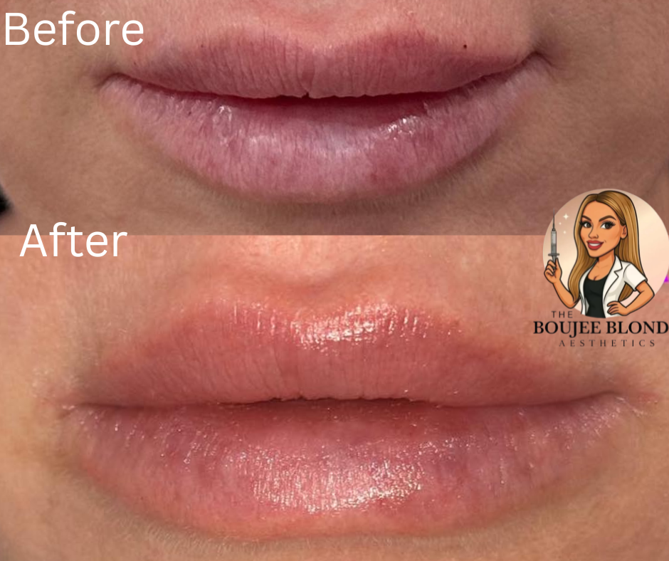 Close-up of lips before and after lip gloss application, showing smoother, shinier lips in after at in slidell at the Boujee Blonde-northshore