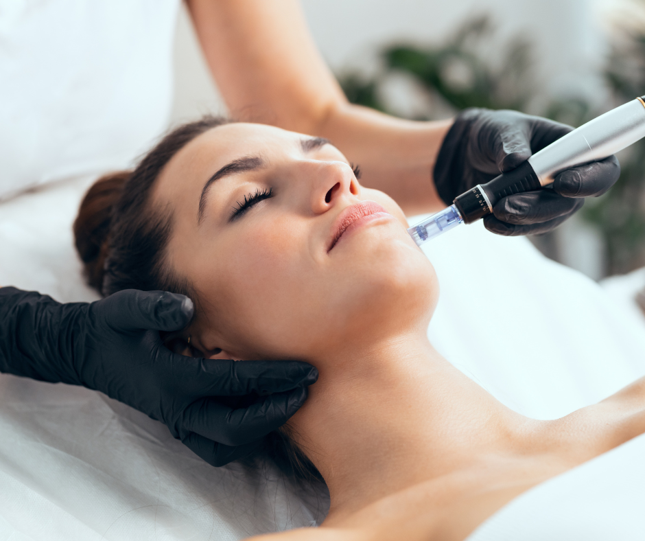 microneedling.png