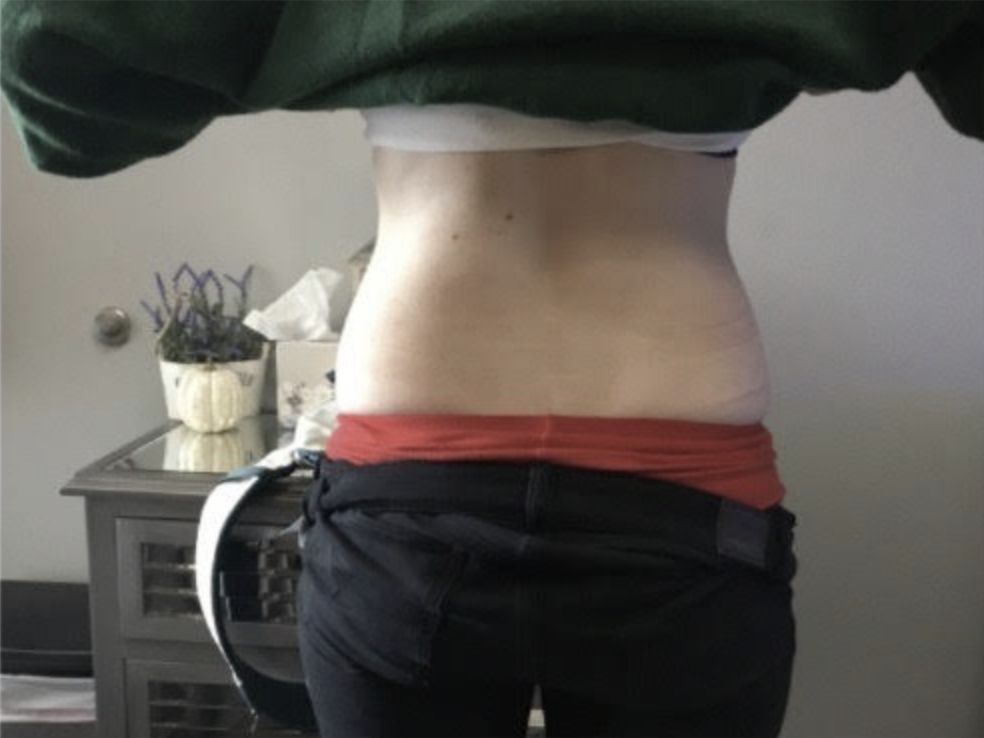 Close-up of a person's midsection showing bare stomach, with the waistband of pants and underwear visible, and a dark shirt lifted above the torso.